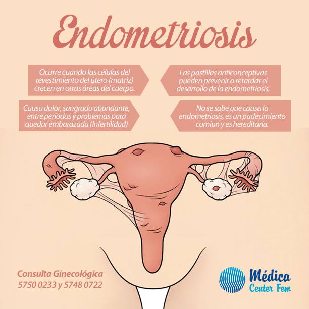 Endometriosis