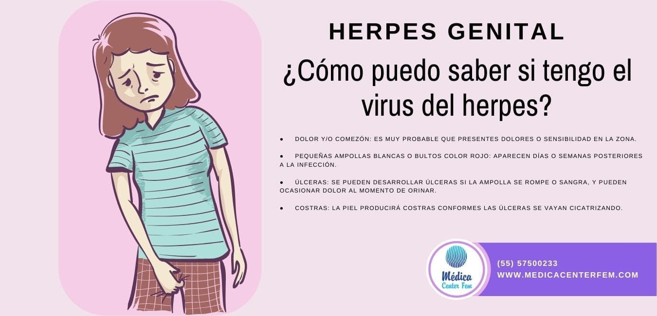 herpes-genital