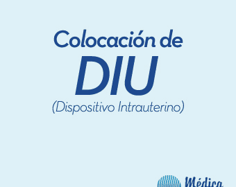 colocación de DIU. alt