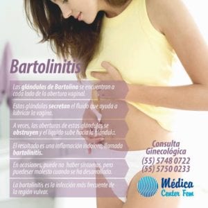 bartolinitis