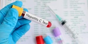 hepatitis c 