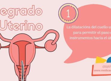 legrado-uterino