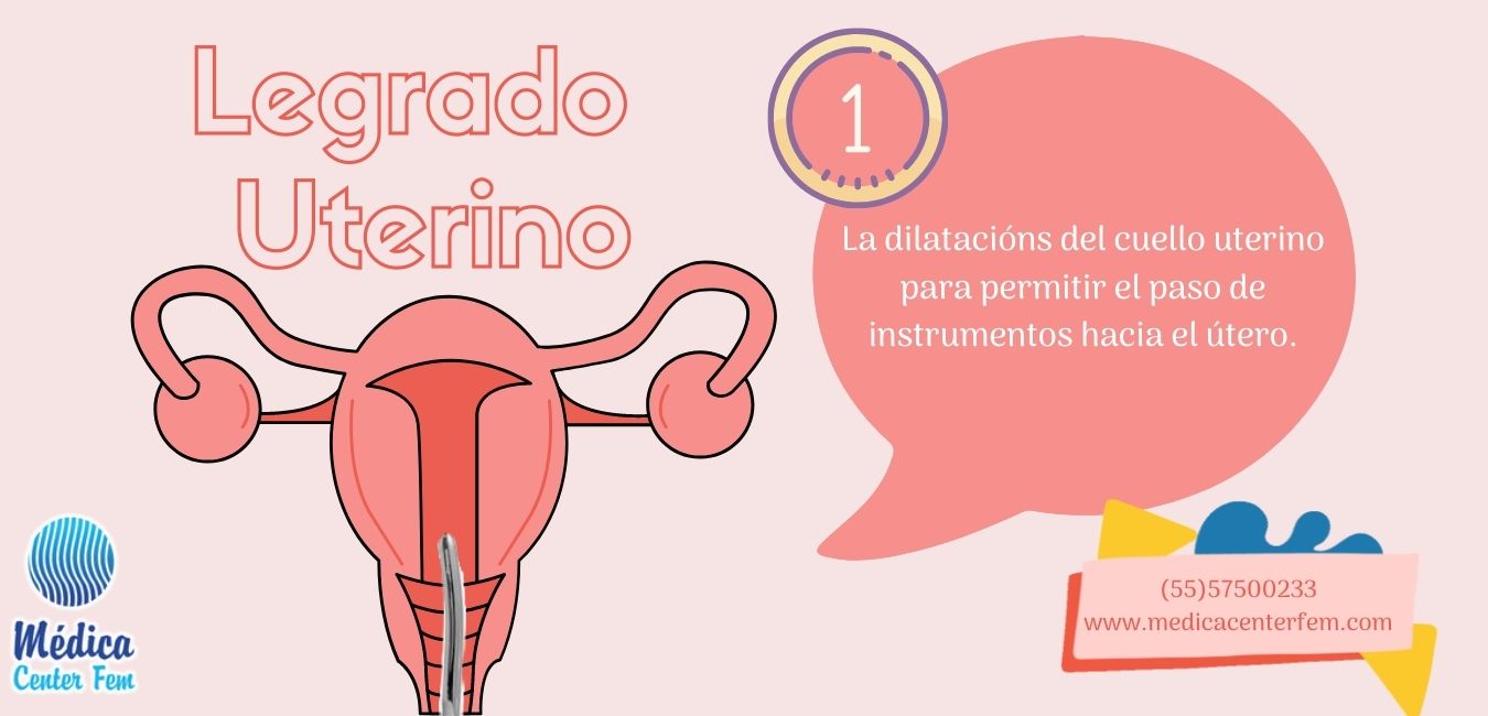 legrado-uterino